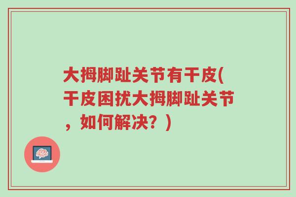 大拇脚趾关节有干皮(干皮困扰大拇脚趾关节,如何解决?)-第1张图片-超越 大拇脚趾关节有干皮(干皮困扰大拇脚趾关节,如何解决?)-第1张图片-超越