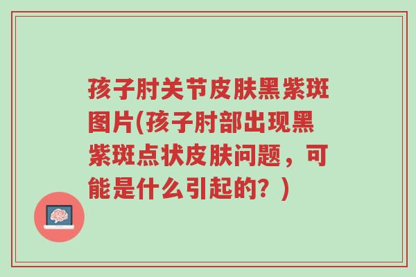孩子肘关节皮肤黑紫斑图片(孩子肘部出现黑紫斑点状皮肤问题,可能是什么引起的?)-第1张图片-超越 孩子肘关节皮肤黑紫斑图片(孩子肘部出现黑紫斑点状皮肤问题,可能是什么引起的?)-第1张图片-超越