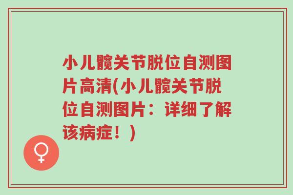 小儿髋关节脱位自测图片高清(小儿髋关节脱位自测图片:详细了解该病症!)-第1张图片-超越 小儿髋关节脱位自测图片高清(小儿髋关节脱位自测图片:详细了解该病症!)-第1张图片-超越