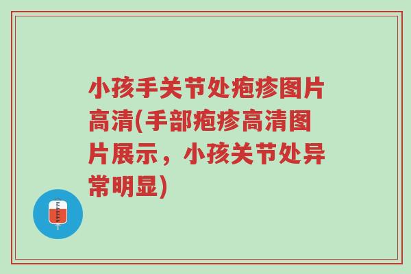 小孩手关节处疱疹图片高清(手部疱疹高清图片展示,小孩关节处异常明显)-第1张图片-超越 小孩手关节处疱疹图片高清(手部疱疹高清图片展示,小孩关节处异常明显)-第1张图片-超越