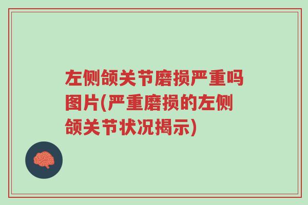 左侧颌关节磨损严重吗图片(严重磨损的左侧颌关节状况揭示)-第1张图片-超越