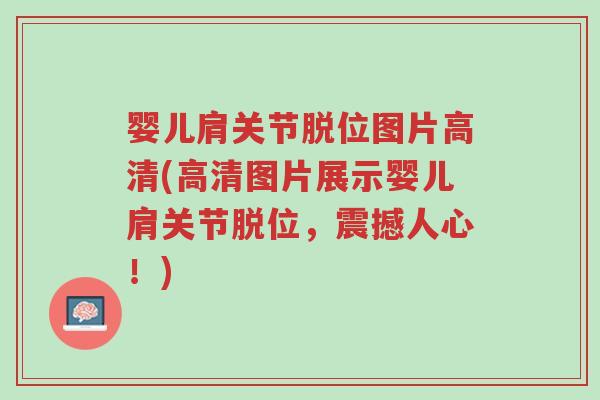 婴儿肩关节脱位图片高清(高清图片展示婴儿肩关节脱位,震撼人心!)-第1张图片-超越 婴儿肩关节脱位图片高清(高清图片展示婴儿肩关节脱位,震撼人心!)-第1张图片-超越