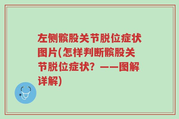 左侧髌股关节脱位症状图片(怎样判断髌股关节脱位症状?——图解详解)-第1张图片-超越 左侧髌股关节脱位症状图片(怎样判断髌股关节脱位症状?——图解详解)-第1张图片-超越