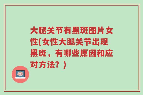 大腿关节有黑斑图片女性(女性大腿关节出现黑斑,有哪些原因和应对方法?)-第1张图片-超越 大腿关节有黑斑图片女性(女性大腿关节出现黑斑,有哪些原因和应对方法?)-第1张图片-超越