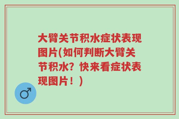 大臂关节积水症状表现图片(如何判断大臂关节积水?快来看症状表现图片!)-第1张图片-超越 大臂关节积水症状表现图片(如何判断大臂关节积水?快来看症状表现图片!)-第1张图片-超越