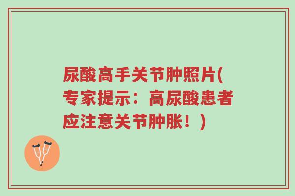 尿酸高手关节肿照片(专家提示：高尿酸患者应注意关节肿胀！)-第1张图片-超越