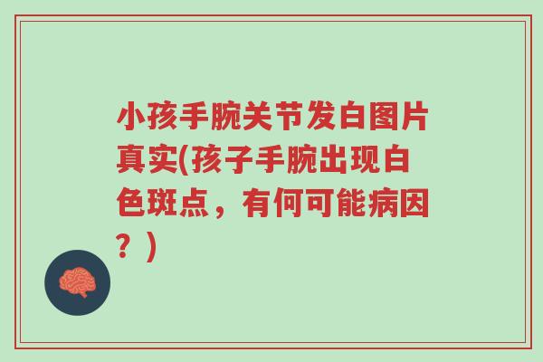 小孩手腕关节发白图片真实(孩子手腕出现白色斑点，有何可能病因？)-第1张图片-超越