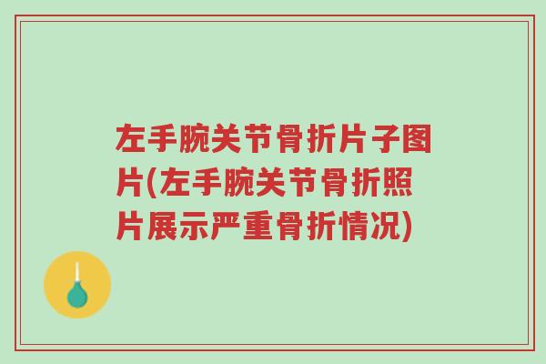 左手腕关节骨折片子图片(左手腕关节骨折照片展示严重骨折情况)-第1张图片-超越 左手腕关节骨折片子图片(左手腕关节骨折照片展示严重骨折情况)-第1张图片-超越