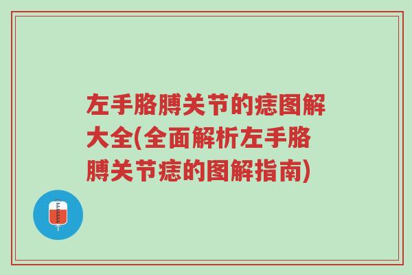 左手胳膊关节的痣图解大全(全面解析左手胳膊关节痣的图解指南)-第1张图片-超越
