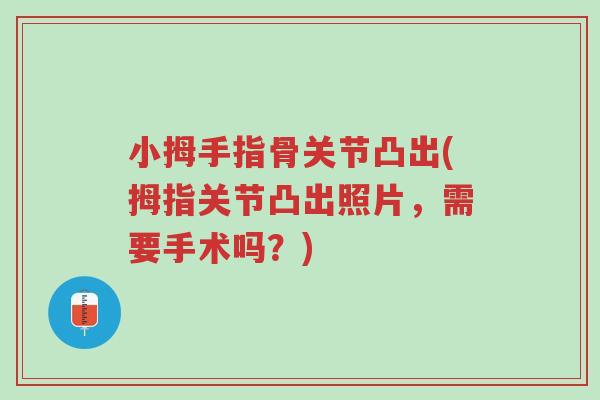 小拇手指骨关节凸出(拇指关节凸出照片,需要手术吗?)-第1张图片-超越 小拇手指骨关节凸出(拇指关节凸出照片,需要手术吗?)-第1张图片-超越