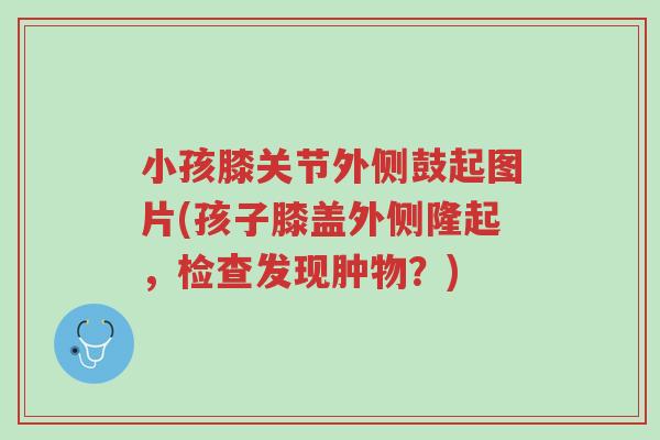 小孩膝关节外侧鼓起图片(孩子膝盖外侧隆起,检查发现肿物?)-第1张图片-超越 小孩膝关节外侧鼓起图片(孩子膝盖外侧隆起,检查发现肿物?)-第1张图片-超越