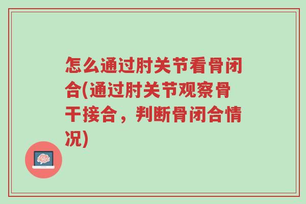 怎么通过肘关节看骨闭合(通过肘关节观察骨干接合,判断骨闭合情况)-第1张图片-超越 怎么通过肘关节看骨闭合(通过肘关节观察骨干接合,判断骨闭合情况)-第1张图片-超越
