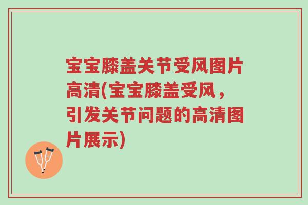 宝宝膝盖关节受风图片高清(宝宝膝盖受风,引发关节问题的高清图片展示)-第1张图片-超越 宝宝膝盖关节受风图片高清(宝宝膝盖受风,引发关节问题的高清图片展示)-第1张图片-超越