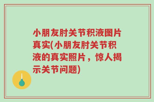 小朋友肘关节积液图片真实(小朋友肘关节积液的真实照片,惊人揭示关节问题)-第1张图片-超越 小朋友肘关节积液图片真实(小朋友肘关节积液的真实照片,惊人揭示关节问题)-第1张图片-超越