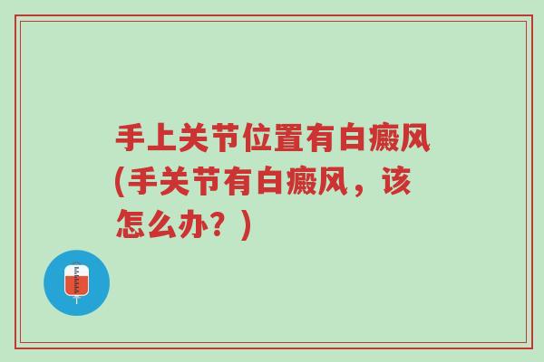 手上关节位置有白癜风(手关节有白癜风,该怎么办?)-第1张图片-超越 手上关节位置有白癜风(手关节有白癜风,该怎么办?)-第1张图片-超越