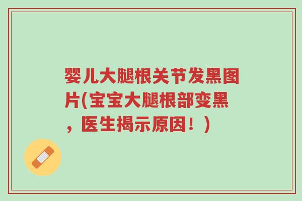 婴儿大腿根关节发黑图片(宝宝大腿根部变黑,医生揭示原因!)-第1张图片-超越 婴儿大腿根关节发黑图片(宝宝大腿根部变黑,医生揭示原因!)-第1张图片-超越