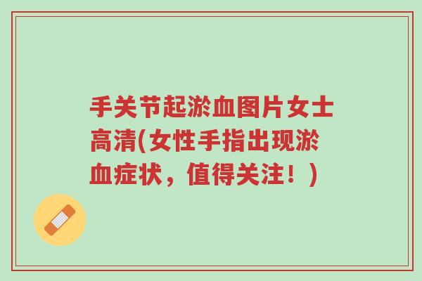 手关节起淤血图片女士高清(女性手指出现淤血症状,值得关注!)-第1张图片-超越 手关节起淤血图片女士高清(女性手指出现淤血症状,值得关注!)-第1张图片-超越
