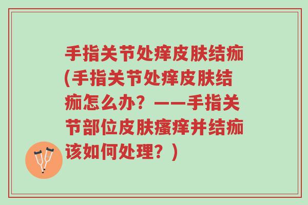 手指关节处痒皮肤结痂(手指关节处痒皮肤结痂怎么办?——手指关节部位皮肤瘙痒并结痂该如何处理?)-第1张图片-超越 手指关节处痒皮肤结痂(手指关节处痒皮肤结痂怎么办?——手指关节部位皮肤瘙痒并结痂该如何处理?)-第1张图片-超越