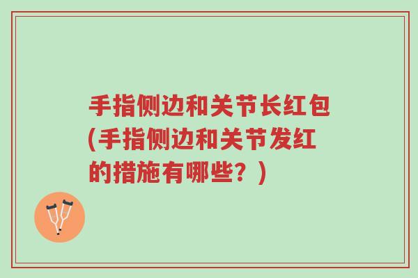 手指侧边和关节长红包(手指侧边和关节发红的措施有哪些?)-第1张图片-超越 手指侧边和关节长红包(手指侧边和关节发红的措施有哪些?)-第1张图片-超越