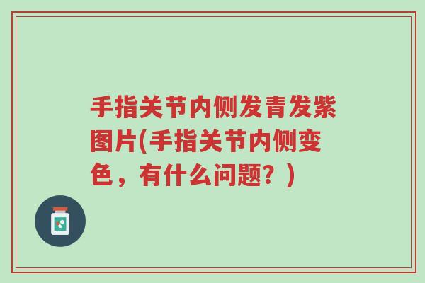手指关节内侧发青发紫图片(手指关节内侧变色,有什么问题?)-第1张图片-超越 手指关节内侧发青发紫图片(手指关节内侧变色,有什么问题?)-第1张图片-超越