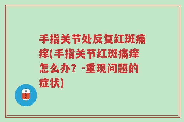 手指关节处反复红斑痛痒(手指关节红斑痛痒怎么办?-重现问题的症状)-第1张图片-超越 手指关节处反复红斑痛痒(手指关节红斑痛痒怎么办?-重现问题的症状)-第1张图片-超越