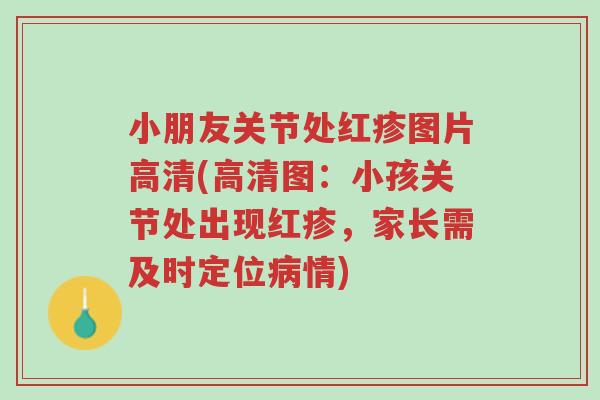 小朋友关节处红疹图片高清(高清图:小孩关节处出现红疹,家长需及时定位病情)-第1张图片-超越 小朋友关节处红疹图片高清(高清图:小孩关节处出现红疹,家长需及时定位病情)-第1张图片-超越