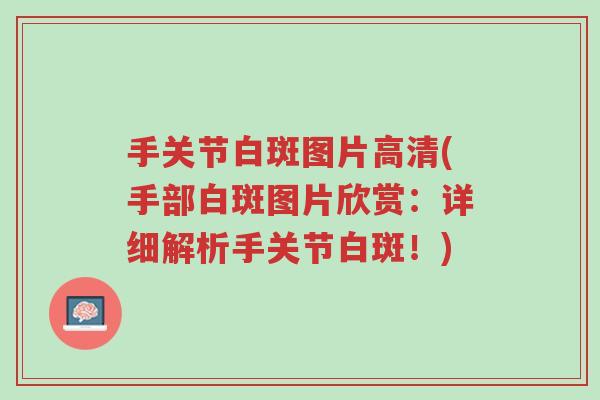 手关节白斑图片高清(手部白斑图片欣赏:详细解析手关节白斑!)-第1张图片-超越 手关节白斑图片高清(手部白斑图片欣赏:详细解析手关节白斑!)-第1张图片-超越