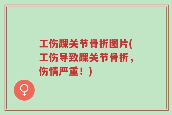 工伤踝关节骨折图片(工伤导致踝关节骨折,伤情严重!)-第1张图片-超越 工伤踝关节骨折图片(工伤导致踝关节骨折,伤情严重!)-第1张图片-超越