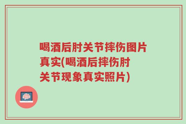 喝酒后肘关节摔伤图片真实(喝酒后摔伤肘 关节现象真实照片)-第1张图片-超越 喝酒后肘关节摔伤图片真实(喝酒后摔伤肘 关节现象真实照片)-第1张图片-超越