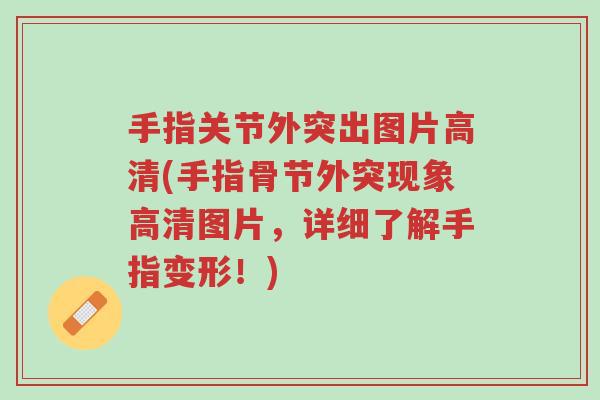 手指关节外突出图片高清(手指骨节外突现象高清图片，详细了解手指变形！)-第1张图片-超越