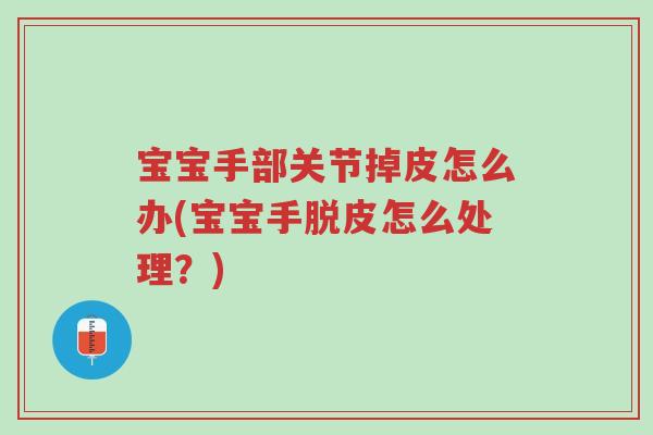 宝宝手部关节掉皮怎么办(宝宝手脱皮怎么处理?)-第1张图片-超越 宝宝手部关节掉皮怎么办(宝宝手脱皮怎么处理?)-第1张图片-超越