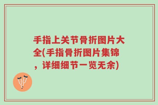 手指上关节骨折图片大全(手指骨折图片集锦,详细细节一览无余)-第1张图片-超越 手指上关节骨折图片大全(手指骨折图片集锦,详细细节一览无余)-第1张图片-超越