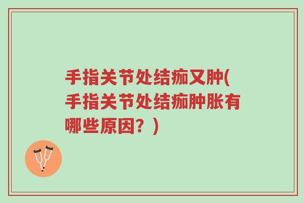 手指关节处结痂又肿(手指关节处结痂肿胀有哪些原因?)-第1张图片-超越 手指关节处结痂又肿(手指关节处结痂肿胀有哪些原因?)-第1张图片-超越