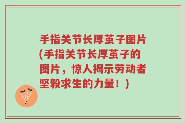 手指关节长厚茧子图片(手指关节长厚茧子的图片，惊人揭示劳动者坚毅求生的力量！)-第1张图片-超越