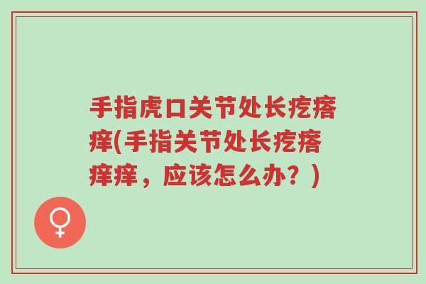 手指虎口关节处长疙瘩痒(手指关节处长疙瘩痒痒,应该怎么办?)-第1张图片-超越 手指虎口关节处长疙瘩痒(手指关节处长疙瘩痒痒,应该怎么办?)-第1张图片-超越