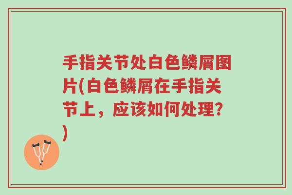 手指关节处白色鳞屑图片(白色鳞屑在手指关节上,应该如何处理?)-第1张图片-超越 手指关节处白色鳞屑图片(白色鳞屑在手指关节上,应该如何处理?)-第1张图片-超越