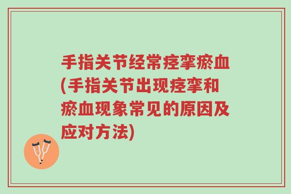 手指关节经常痉挛瘀血(手指关节出现痉挛和瘀血现象常见的原因及应对方法)-第1张图片-超越 手指关节经常痉挛瘀血(手指关节出现痉挛和瘀血现象常见的原因及应对方法)-第1张图片-超越
