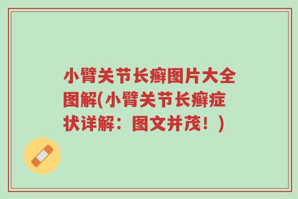 小臂关节长癣图片大全图解(小臂关节长癣症状详解：图文并茂！)-第1张图片-超越
