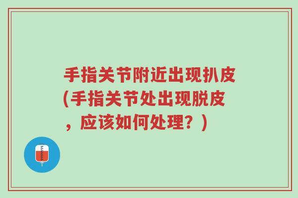 手指关节附近出现扒皮(手指关节处出现脱皮，应该如何处理？)-第1张图片-超越