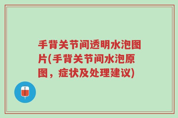 手背关节间透明水泡图片(手背关节间水泡原图,症状及处理建议)-第1张图片-超越 手背关节间透明水泡图片(手背关节间水泡原图,症状及处理建议)-第1张图片-超越