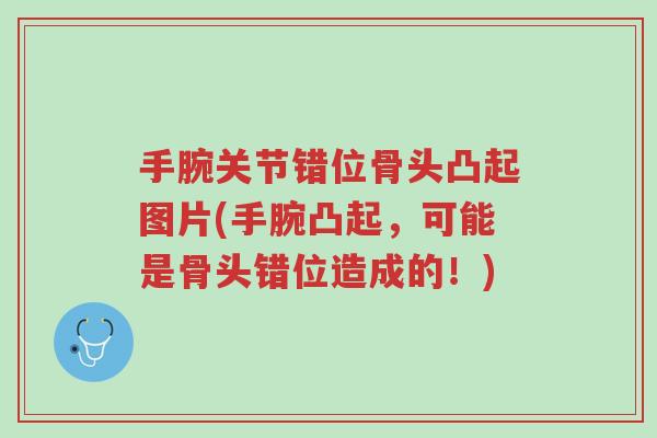 手腕关节错位骨头凸起图片(手腕凸起,可能是骨头错位造成的!)-第1张图片-超越 手腕关节错位骨头凸起图片(手腕凸起,可能是骨头错位造成的!)-第1张图片-超越