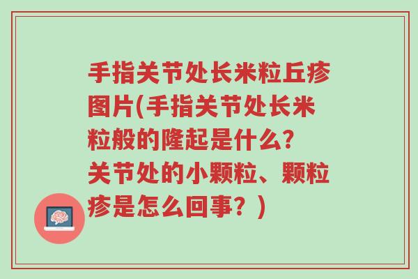 手指关节处长米粒丘疹图片(手指关节处长米粒般的隆起是什么？ 关节处的小颗粒、颗粒疹是怎么回事？)-第1张图片-超越