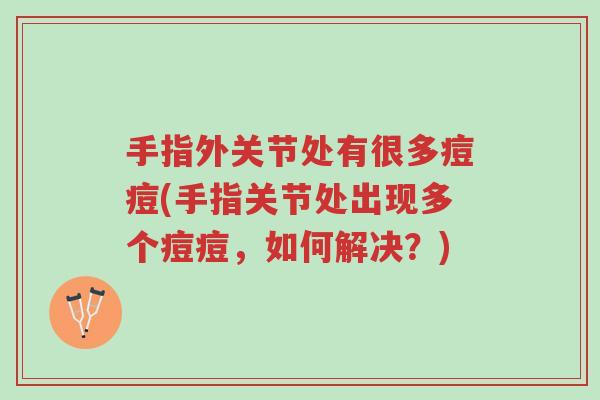 手指外关节处有很多痘痘(手指关节处出现多个痘痘,如何解决?)-第1张图片-超越 手指外关节处有很多痘痘(手指关节处出现多个痘痘,如何解决?)-第1张图片-超越