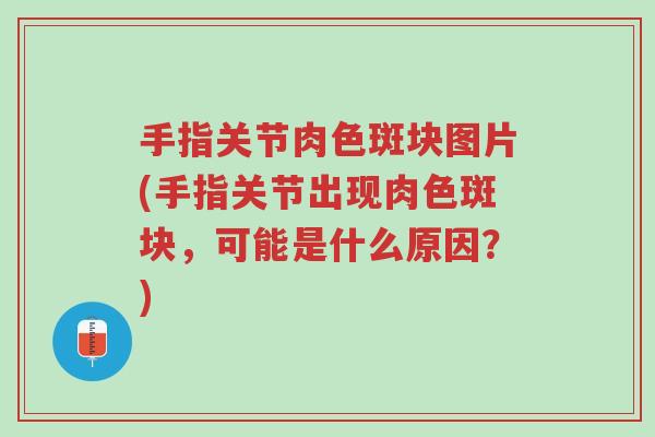 手指关节肉色斑块图片(手指关节出现肉色斑块,可能是什么原因?)-第1张图片-超越 手指关节肉色斑块图片(手指关节出现肉色斑块,可能是什么原因?)-第1张图片-超越