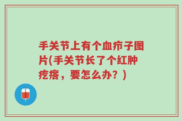 手关节上有个血疖子图片(手关节长了个红肿疙瘩,要怎么办?)-第1张图片-超越 手关节上有个血疖子图片(手关节长了个红肿疙瘩,要怎么办?)-第1张图片-超越