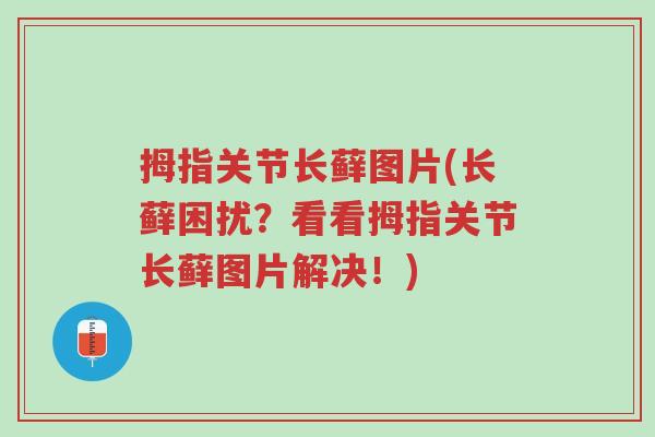 拇指关节长藓图片(长藓困扰？看看拇指关节长藓图片解决！)-第1张图片-超越