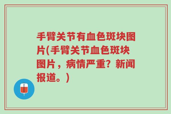 手臂关节有血色斑块图片(手臂关节血色斑块图片,病情严重?新闻报道。)-第1张图片-超越 手臂关节有血色斑块图片(手臂关节血色斑块图片,病情严重?新闻报道。)-第1张图片-超越