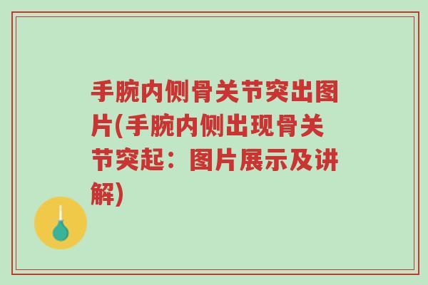 手腕内侧骨关节突出图片(手腕内侧出现骨关节突起:图片展示及讲解)-第1张图片-超越 手腕内侧骨关节突出图片(手腕内侧出现骨关节突起:图片展示及讲解)-第1张图片-超越