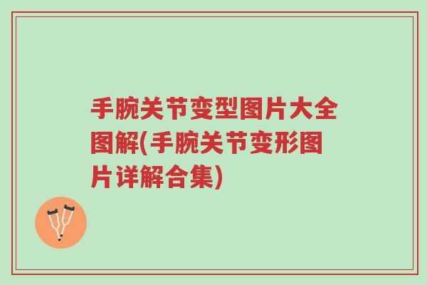 手腕关节变型图片大全图解(手腕关节变形图片详解合集)-第1张图片-超越 手腕关节变型图片大全图解(手腕关节变形图片详解合集)-第1张图片-超越