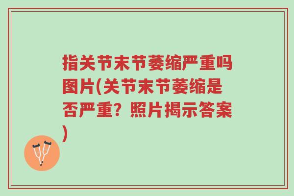指关节末节萎缩严重吗图片(关节末节萎缩是否严重?照片揭示答案)-第1张图片-超越 指关节末节萎缩严重吗图片(关节末节萎缩是否严重?照片揭示答案)-第1张图片-超越